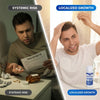 Hair-Regen: 5% Minoxidil Hair Regrowth Treatment for Men