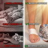 PediFix® QuickTape® Support Straps